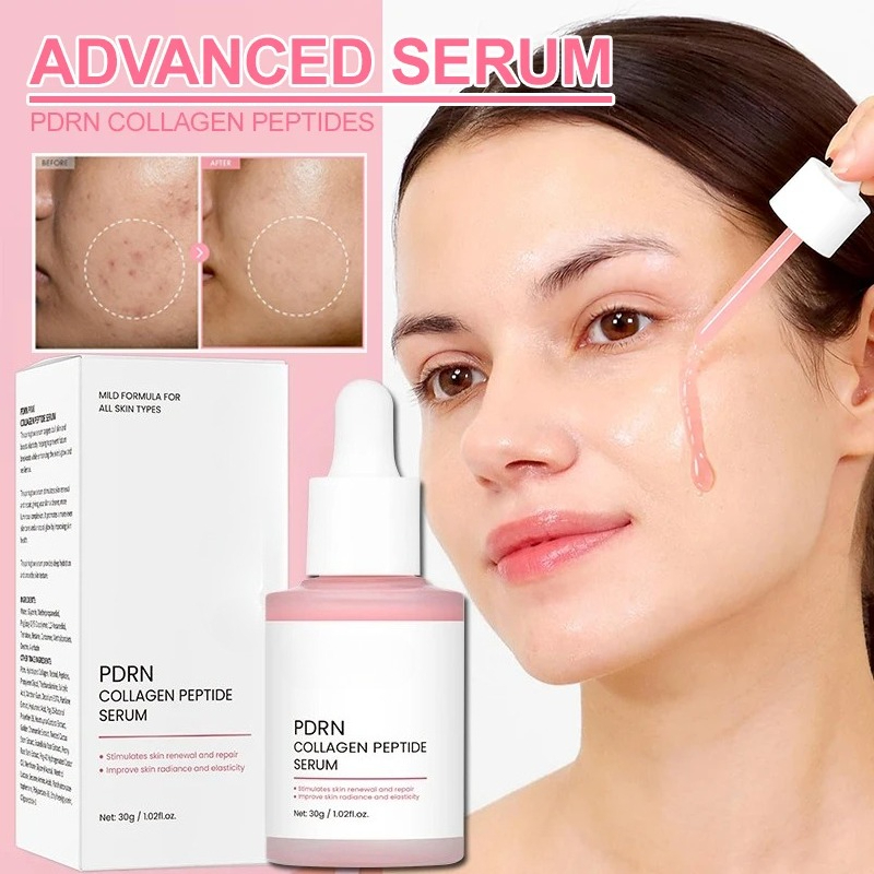 Serum
